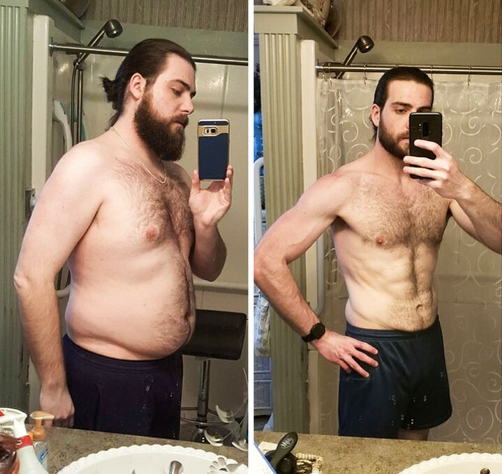 ABSLIM man before and after the application