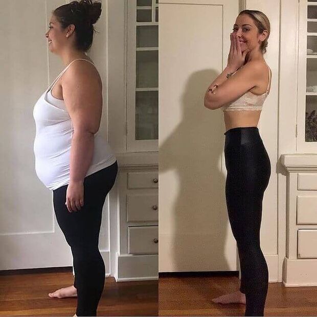 The woman before and after using ABSLIM
